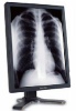 Monitor medical diagnosticare KOSTEC D213Q5E-CA