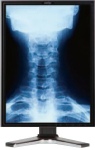 Monitor medical diagnosticare KOSTEC D213U8-S