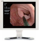 Monitor medical chirurgie KOSTEC E190S4