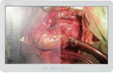 Monitor medical chirurgie KOSTEC E260FB